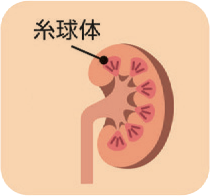 糸球体のイラスト