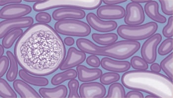 正常な腎臓の組織